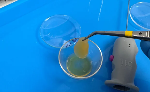 platelet-rich fibrin dental procedure-01 platelet-rich fibrin dental procedure-01