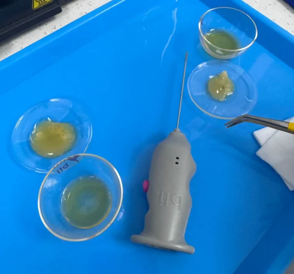 platelet-rich fibrin dental procedure-02 platelet-rich fibrin dental procedure-02