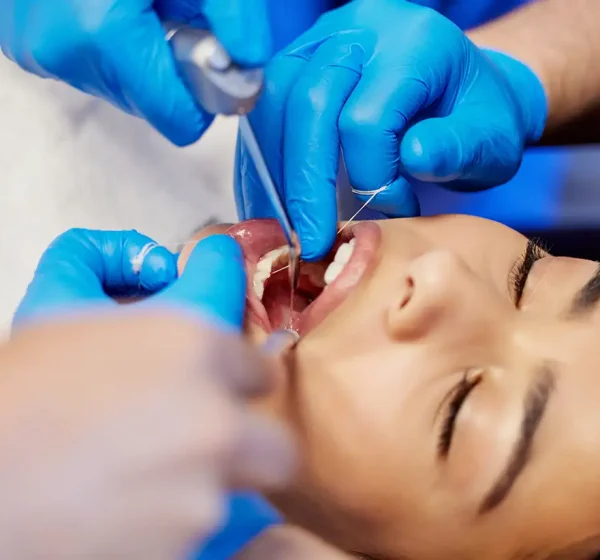 Tooth extractions Tooth extractions
