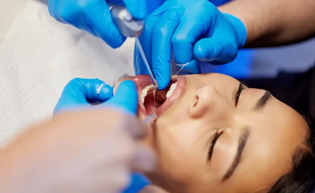 Tooth extractions Tooth extractions