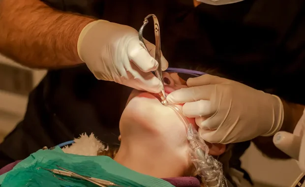 Wisdom teeth removal Wisdom teeth removal
